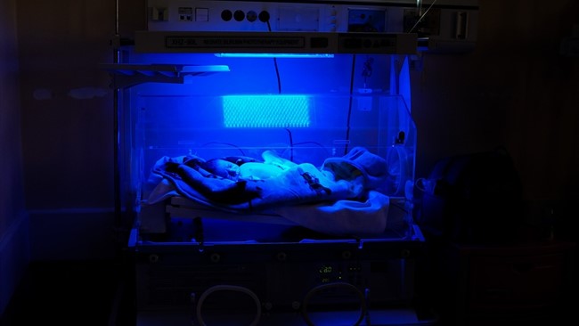 سخنگوی وزارت بهداشت، درباره اخبار نوزاد فوت شده در بیمارستان امام سجاد (ع) شهریار، توضیحاتی ارائه داد.