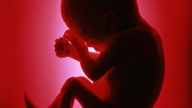 معاون امور معاینات بالینی سازمان پزشکی قانونی با تشریح جزئیات دستورالعمل جدید صدور مجوز سقط جنین، از صدور نزدیک به ۸۹۰۰ مجوز سقط جنین در سال گذشته خبر داد.