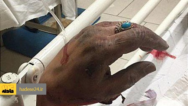 یک حلقه انگشترکه برای زن 35 ساله ای در هنگام درمان در بیمارستان شهدای یافت آباد دردسرآفرین شده بود، با تلاش آتش نشانان رهاسازی شد.