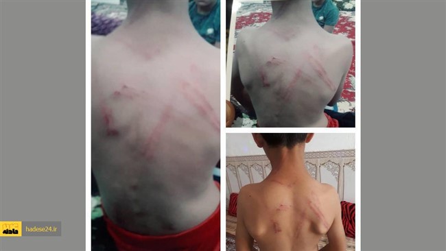 معلم ورزش اهل شهرستان کارون (خوزستان) با شلاق‌های بی رحمانه کودک ۹ ساله را مورد تنبیه قرار داد.