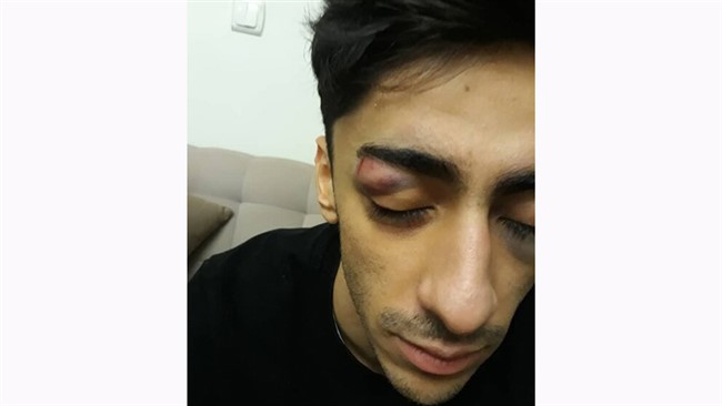 یکی از ملی پوشان ژیمناستیک ایران پس از تمرین در سالن ژیمناستیک برادران شهید آذرپی مورد ضرب و شتم قرار گرفت.
