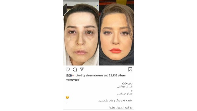 مهراوه شریفی نیا دو عکس از گریم متفاوتش را در سریال دل را منتشر کرد.