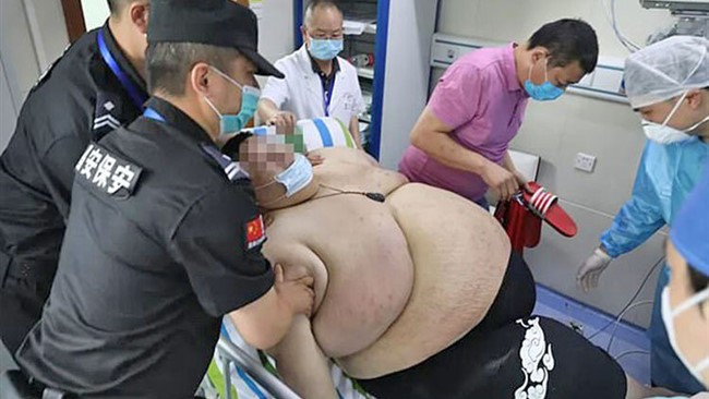 یک جوان چینی که پیش از آغاز قرنطینه کرونا در ووهان چین حدود ۱۷۸ کیلو وزن داشت، در پنج ماه گذشته بیش از ۱۰۰ کیلوگرم دیگر به وزن خود افزود و حالا برای کاهش وزن در بیمارستان بستری است.