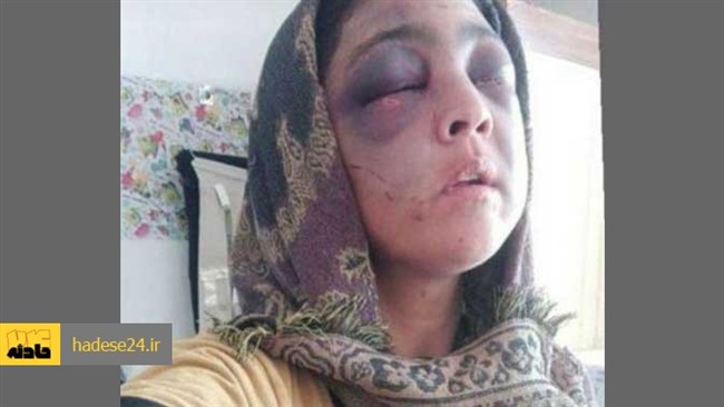 تصویر جدیدی از همسرآزاری دردناک در رودبار گیلان که در فضای مجازی منتشر شده است.