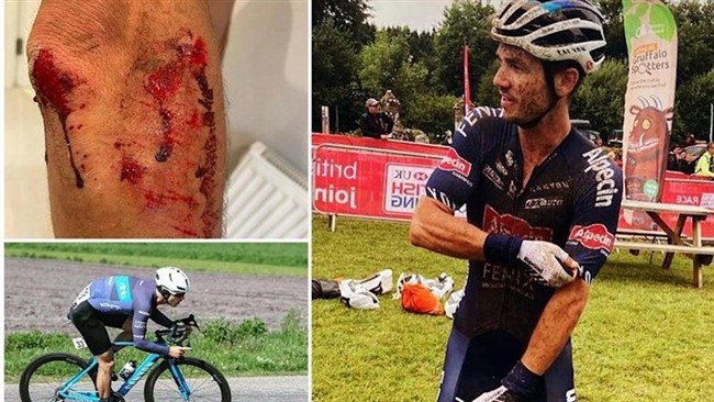 تعدادی سارق با حمله به عضو تیم ملی دوچرخه‌سواری انگلیس در یکی از خیابان‌های لندن برای ربودن دوچرخه گران‌قیمت وی متوسل به سلاح سرد شدند.