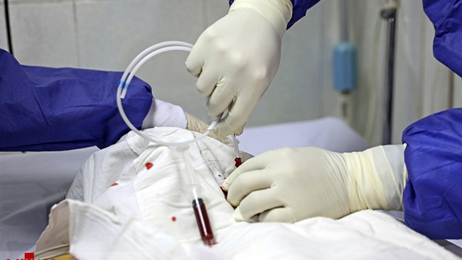معاون درمان دانشگاه علوم پزشکی قزوین گفت: در ۲۴ ساعت گذشته، یک فرد ۴۸ ساله اهل آبیک بر اثر ابتلا به ویروس کرونا درگذشت، بررسی‌ها نشان داد که وی به نوع کرونای انگلیسی مبتلا بوده است.