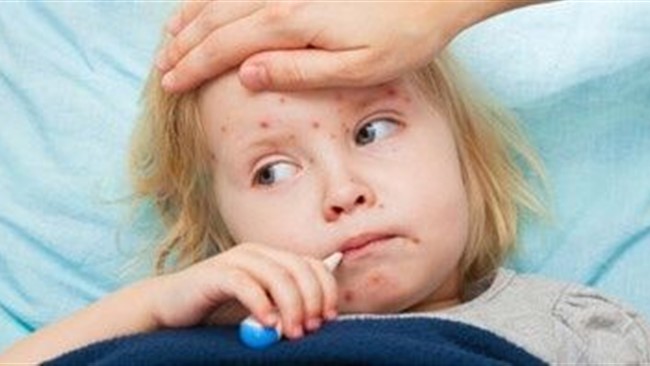 در انگلیس شمار کودکانی که پس از بهبودی از بیماری کووید۱۹ به یک بیماری شبیه کاوازاکی مبتلا می‌شوند افزایش یافته و گفته می‌شود که دست‌کم دو کودک بر اثر این بیماری جان باخته‌اند.