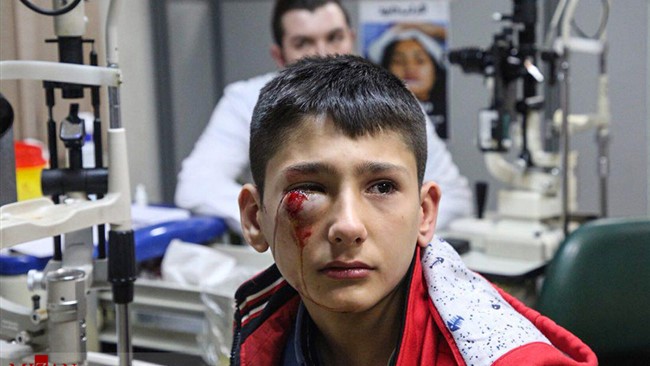 به گفته یک چشم پزشک درصد قابل توجهی از آسیب‌های چشمی که به دلیل حوادث چهارشنبه سوری رخ می‌دهند، غیر قابل بازگشت هستند و موجب کوری فرد می‌شوند.