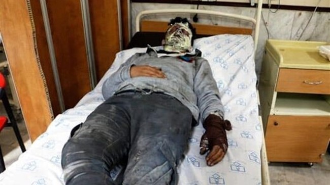 رییس مرکز اورژانس تهران گفت: انفجار نارنجک چهارشنبه سوری در ری نوجوان ۱۷ ساله را با سوختگی دست و صورت راهی بیمارستان کرد.