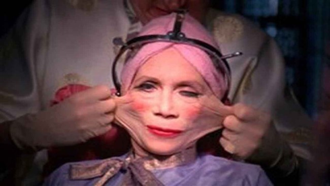در حالی که جراحی پلاستیک برای زیبایی کاربرد دارد، چهره برخی از افراد به دلایل مختلفی پس از جراحی پلاستیک، به طور وحشتناکی تغییر می‌کند.