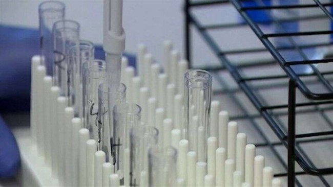 رئیس اتحادیه واردکنندگان دارو از گشایش‌های جدید در عرصه واردات واکسن به کشور خبر داد.