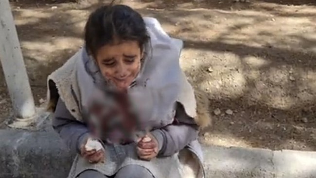 از صبح امروز فیلم وتصاویری از یک دختر خردسال با صورت خونی در فضای مجازی پخش شده است. پلیس اصفهان در این خصوص اعلام کرد: اصل ماجرا دعوای دو دانش آموز بوده که ورود مادر یکی از آنها و دفاع از دخترش منجر به آسیب دیدن این دختر دانش‌آموز می‌شود.