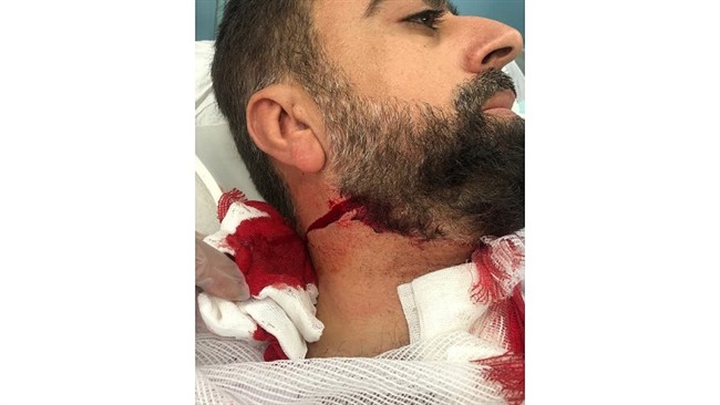تصاویری از جراحت روحانی‌ای که در خیابان رودکی تهران مورد حمله افراد ناشناس قرار گرفت، منتشر شده است.