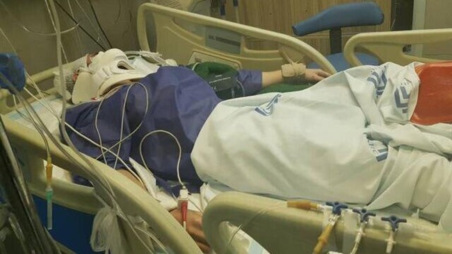 انفجار ترقه در خانه‌ای در همدان، 4عضو یک خانواده را راهی بیمارستان کرد.