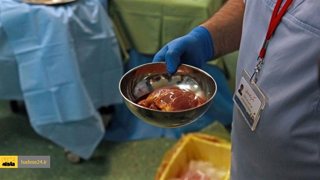 اهدای اعضای جوان مرگ مغزی در دانشگاه علوم پزشکی مشهد، موجب نجات و ادامه زندگی ۵ بیمار نیازمند به عضو شد.