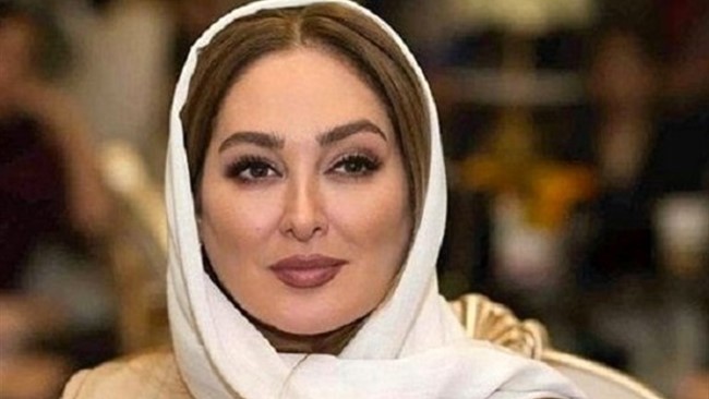 عکس جدید الهام حمیدی، بازیگر سریال یوسف پیامبر به همراه حیوان خانگی‌اش در شبکه‌های اجتماعی مورد توجه قرار گرفت.