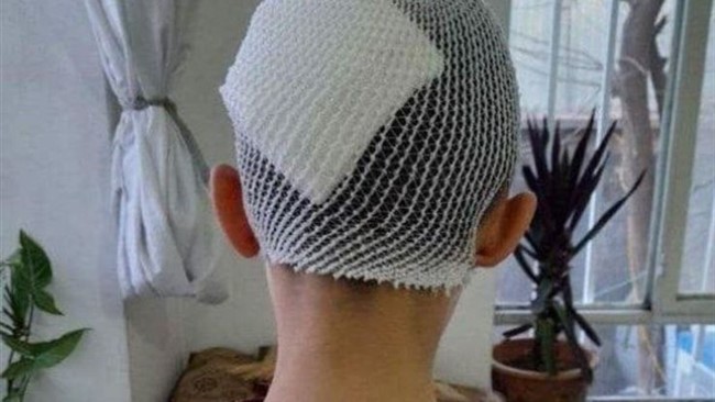 حادثه‌ای تکان‌دهنده در یکی از مدارس شهر گلستان، بار دیگر زنگ خطر خشونت در مدارس را به صدا درآورد، جایی که بنا به روایت شاهدان، عصبانیت یک معلم با پرتاب لیوان به سمت دانش‌آموز پایه دوازدهم، به شکافتن سر او و اعزامش به بیمارستان منجر شد.