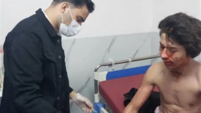 اتاقک کارگران فصلی کشاورزی در روستای مغدان شهرستان دیر استان بوشهر دچار آتش سوزی شد که در نتیجه آن ۴ کارگر زخمی شدند.