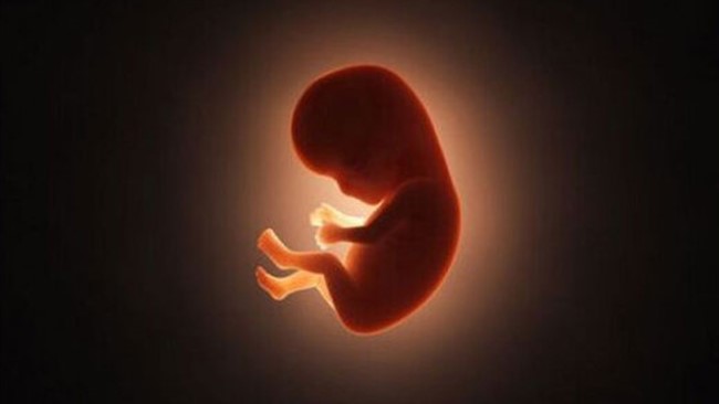 دادستان عمومی و انقلاب مرکز استان سمنان، از شناسایی و دستگیری یک شبکه سازمان‌یافته فعال در زمینه سقط غیرقانونی جنین در شهرستان سمنان خبر داد.