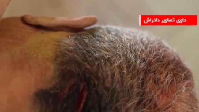 «بچه‌ام رو باید با دستای خودم بفرستم زیر خاک. بچه نازنینم رو باید با دستای خودم بفرستم زیر خاک.» فریاد این مادر، ظهر روز دوشنبه ۲۲ دی ۱۴۰۴، در گوش تمام خانواده‌هایی که جلوی ساختمان پزشکی قانونی کهریزک منتظر شناسایی اجساد عزیزان‌شان بودند، پیچید.