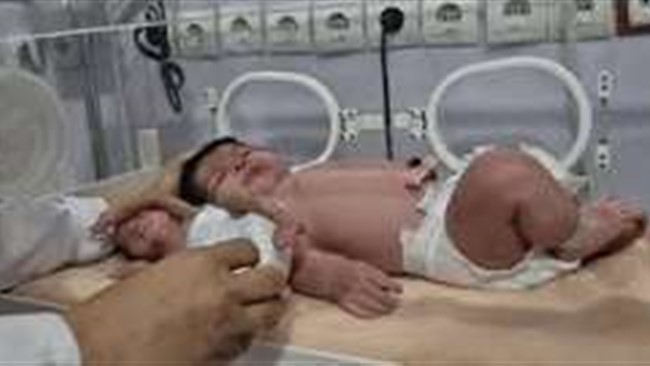 رئیس بخش مراقبت‌های ویژه نوزادان بیمارستان خلیج فارس بندرعباس از تولد نوزادی با وزن ۵ کیلو و ۷۰۰ گرم در این شهر خبر داد و گفت: نوزاد نارس دیگری که با وزن کمتر از ۵۰۰ گرم از میناب به بندرعباس منتقل شده بود نیز اکنون به وزن حدود ۸۰۰ گرم رسیده و هر دو نوزاد در سلامت هستند.