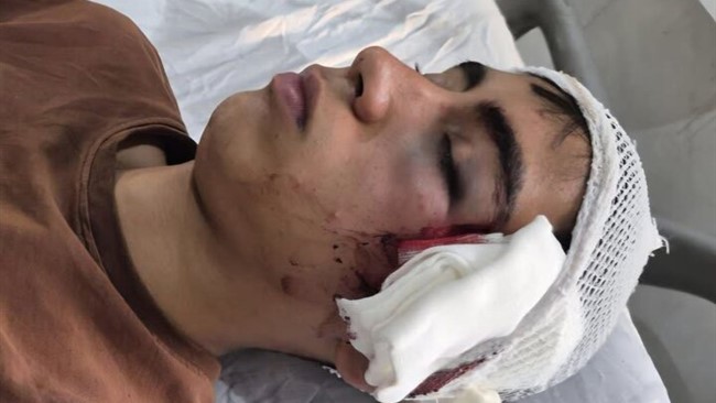 چهارشنبه ۲۹ مهرماه در یکی از دبیرستان‌های دهبکری شهرستان بم، ورود یک دانش‌آموز کلاس یازدهم برای پرسش درباره برگزاری کلاس درس، به درگیری فیزیکی با معلم و مصدومیت شدید وی از ناحیه سر و صورت منجر شد.